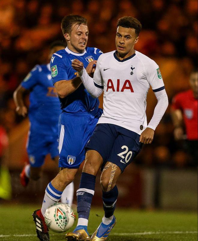 优化了联赛 优化了联赛